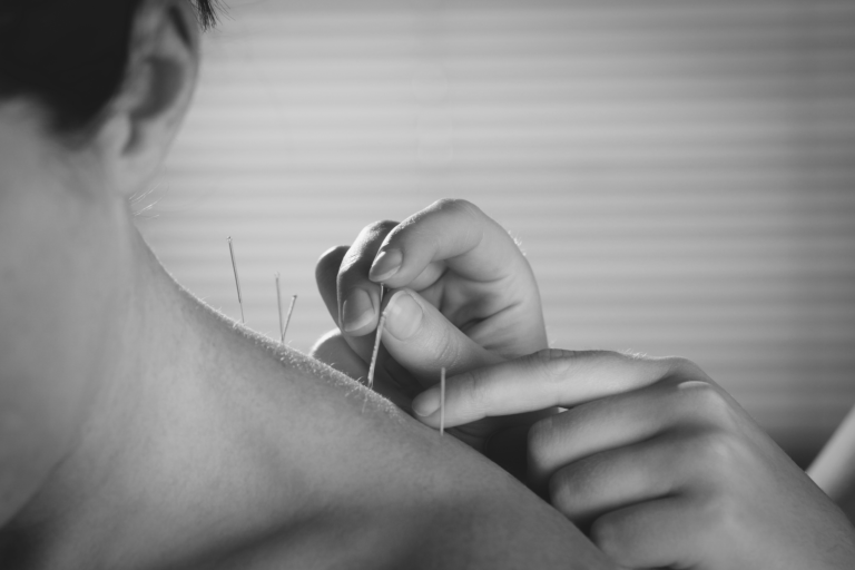 Read more about the article NEW BENEFIT! ACUPUNCTURE TREATMENT
